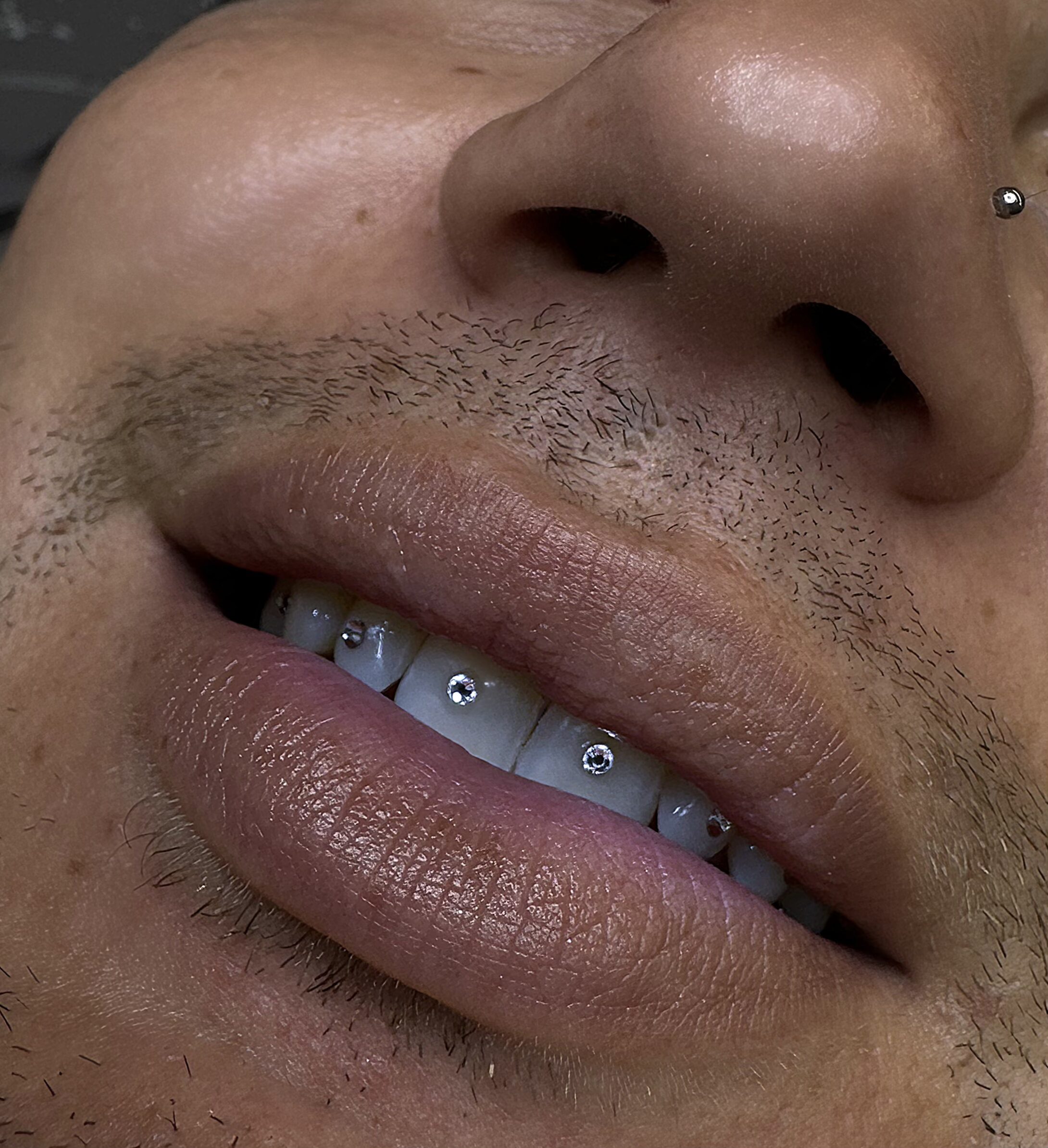 Sorriso con gemme dentali Swarovski applicate, primo piano